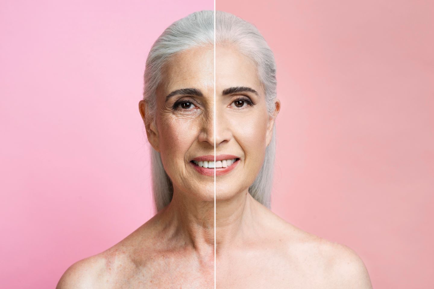 tretinoin before and after aging